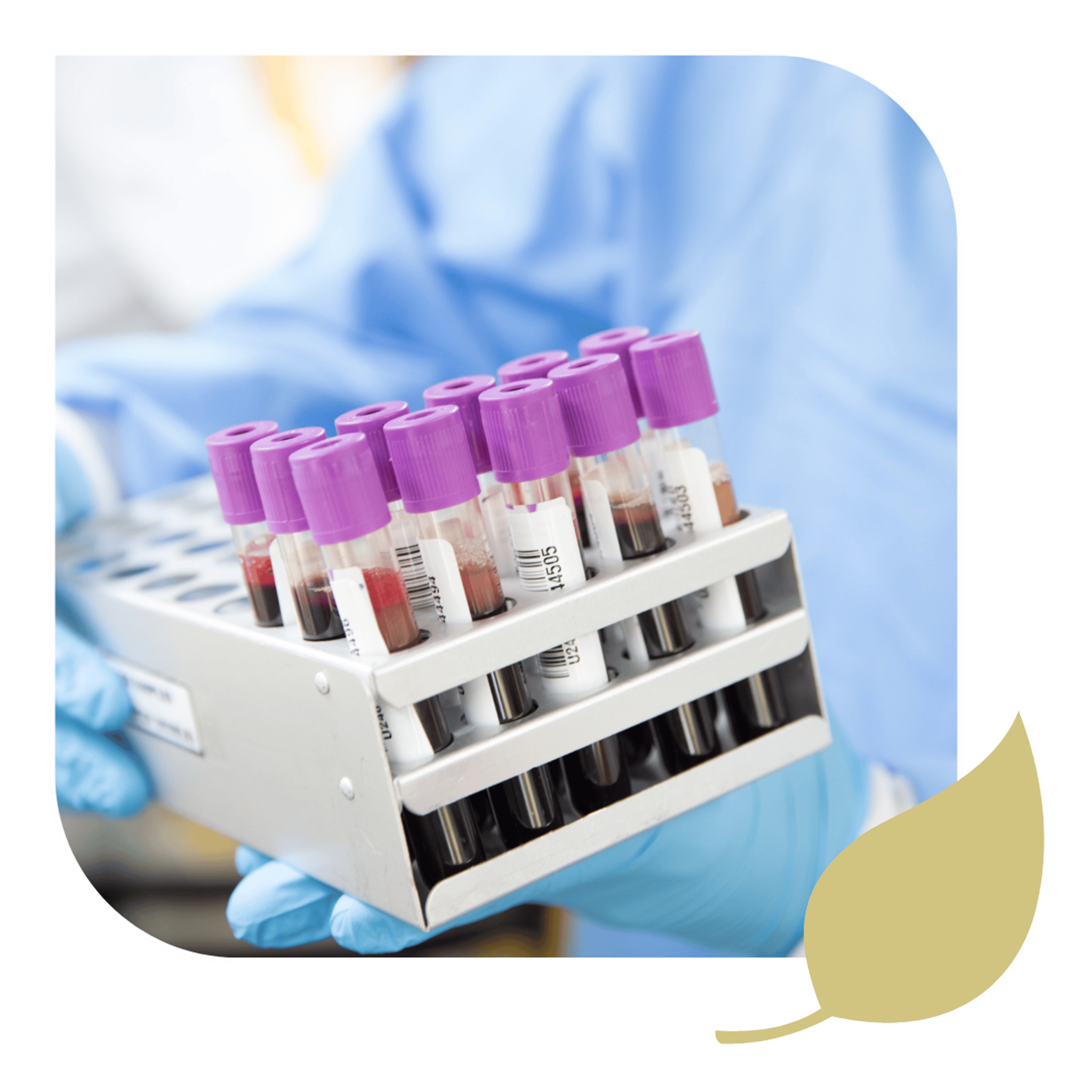 Flasks used for Metabolic Testing being handled by a professional.